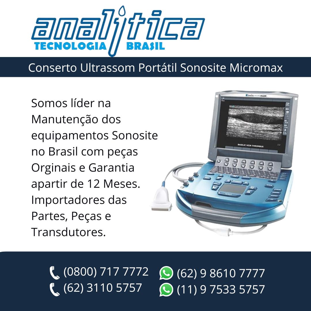 CONSERTO-ULTRASSOM-SONOSITE-MICROMAXX